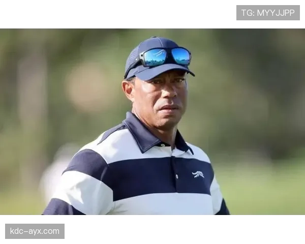 泰格·伍兹连擦杆的手套都比我年薪贵